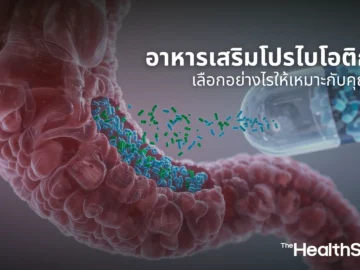 อาหารเสริมโปรไบโอติกจำเป็นไหม เลือกอย่างไรให้เหมาะกับคุณ