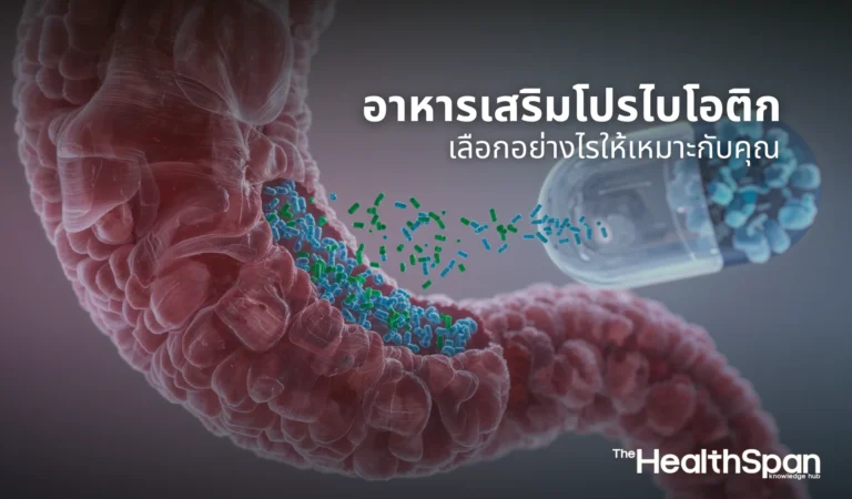 อาหารเสริมโปรไบโอติกจำเป็นไหม เลือกอย่างไรให้เหมาะกับคุณ
